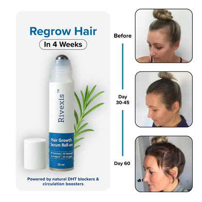 Rivexis™ Hair Regrowth System