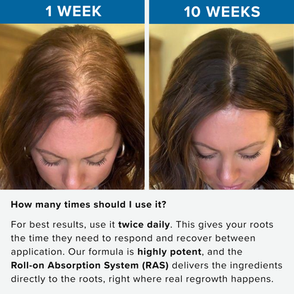 Rivexis™ Hair Regrowth System