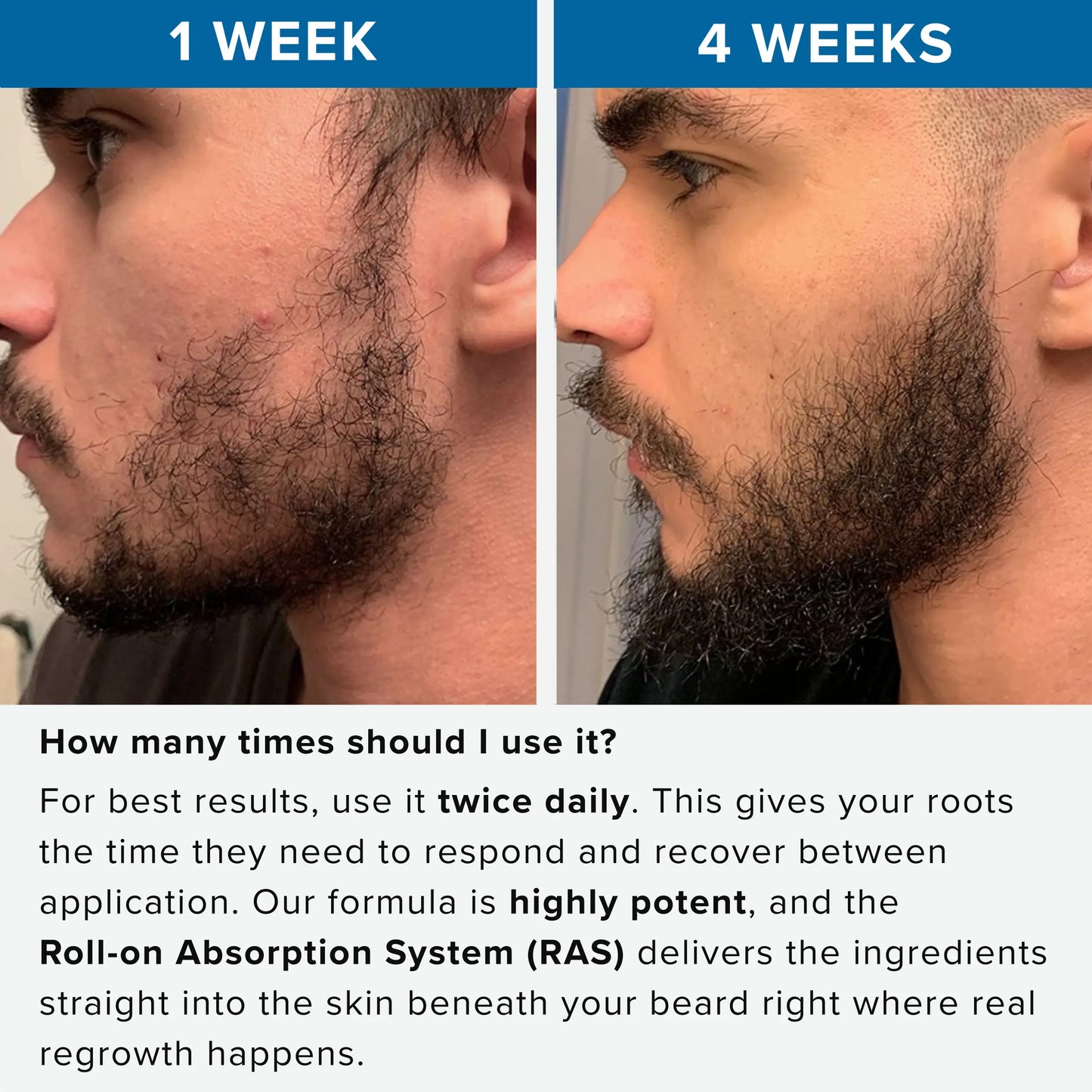 Rivexis™ Beard Activation Serum