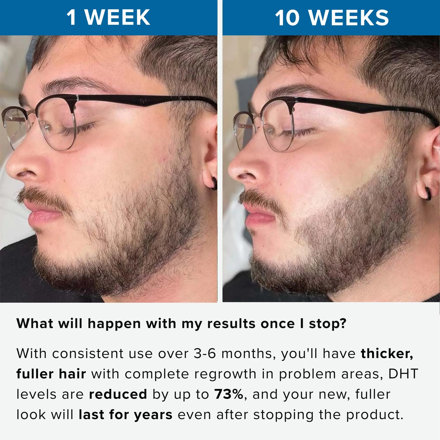 Rivexis™ Beard Activation Serum