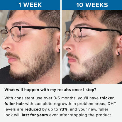 Rivexis™ Beard Activation Serum