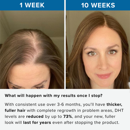 Rivexis™ Hair Regrowth System