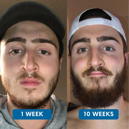 Rivexis™ Beard Activation Serum