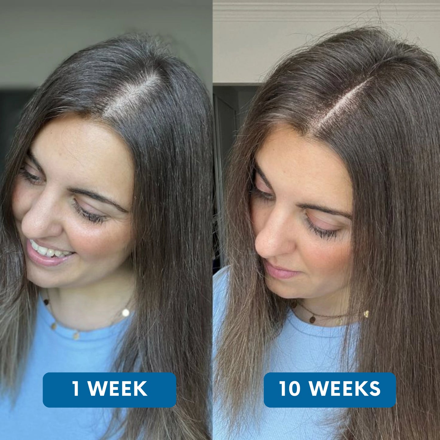 Rivexis™ Hair Regrowth System